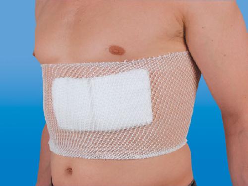 NOBANETZ, síťový trubkový obvaz, délka 25 m, velikost 10 = extra velký dospělý trup